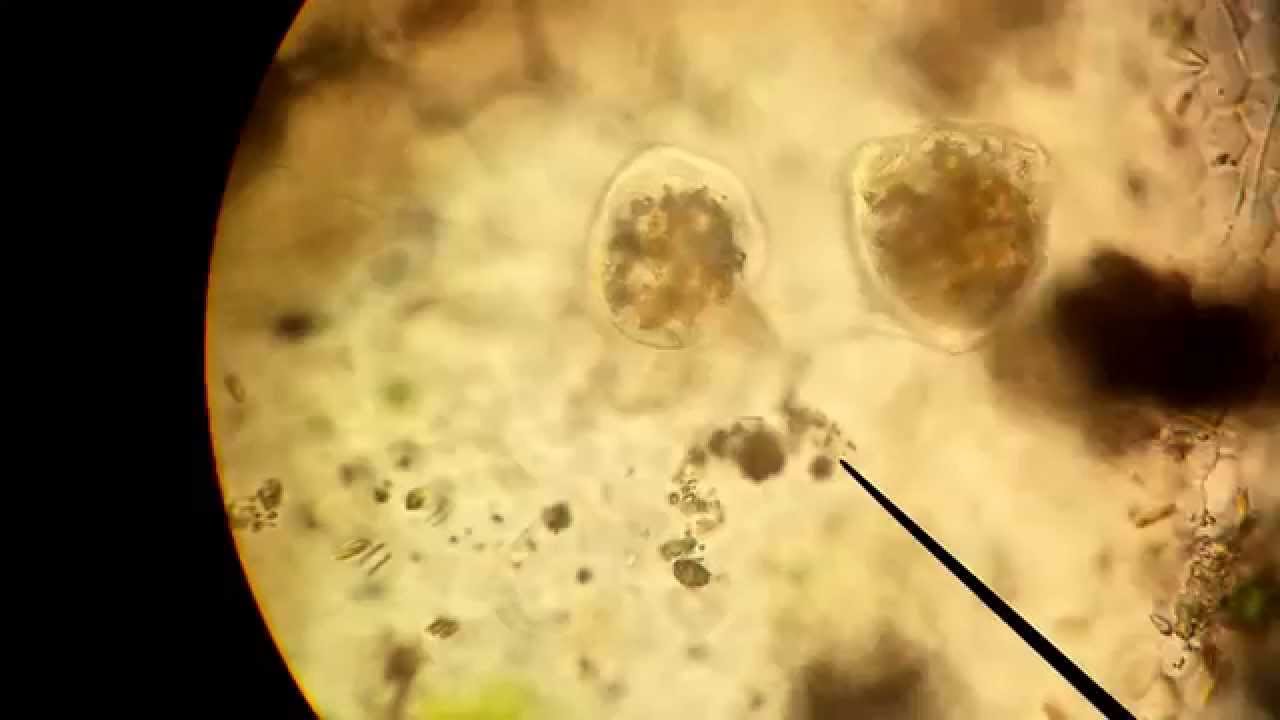 vorticella - in pond water