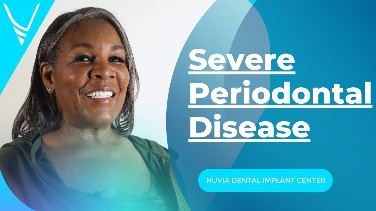 She Had Severe Periodontal Disease & High Dental Anxiety