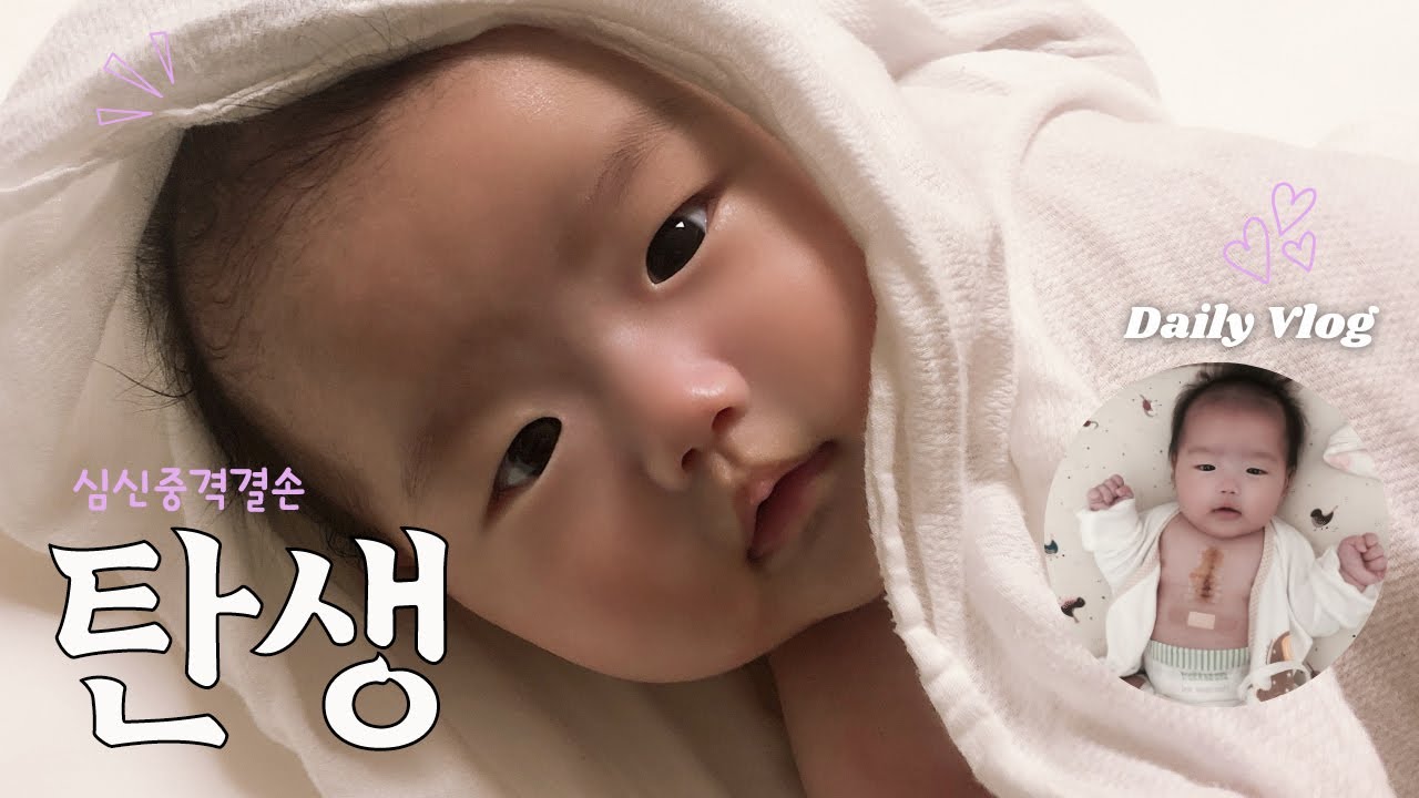 루아의 탄생 !! 근데 아기 심장에 구멍이? ㅣ 신생아 심실중격결손