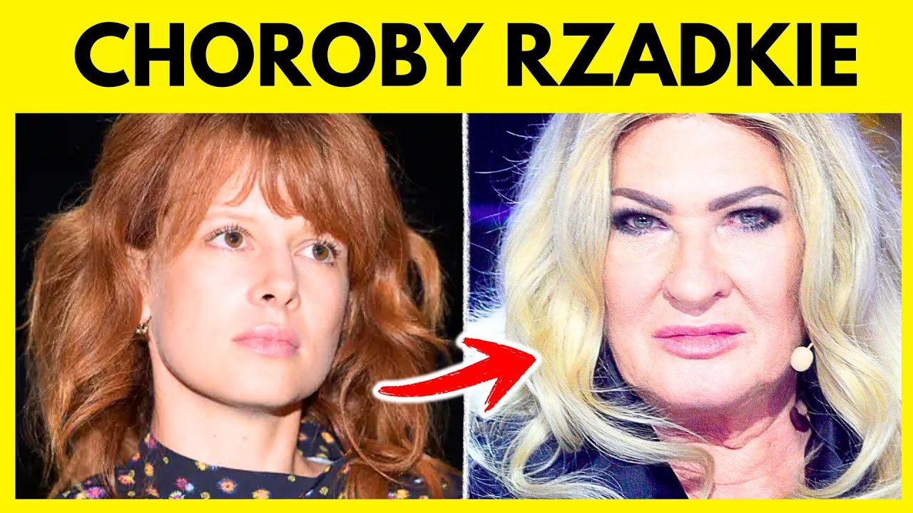 20 gwiazd walczących o życie — choroby rzadkie, rak i degeneracja