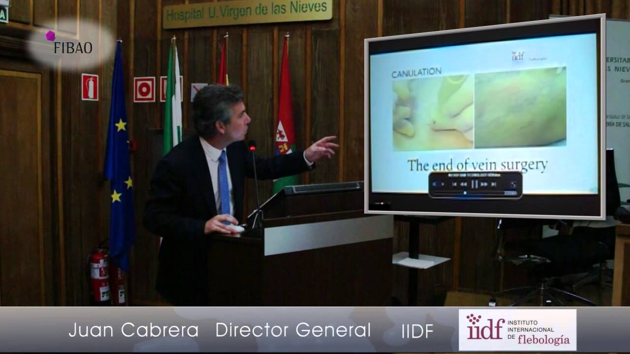 Microespuma esclerosante