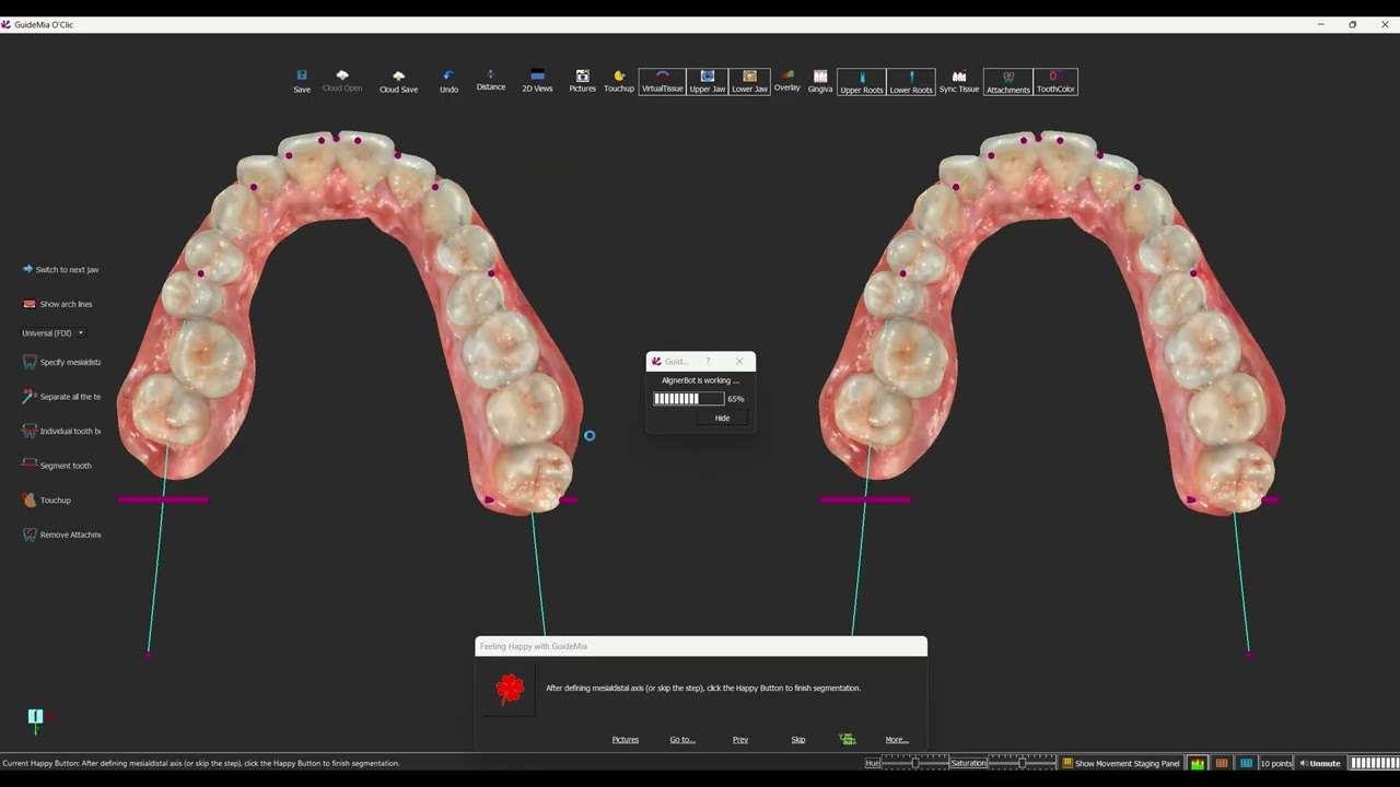 GuideMia OrthoClic V8 Demo