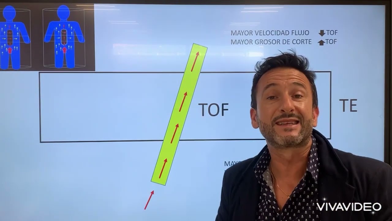 El fenómeno del flujo en RM como base para la ANGIO RM sin contraste