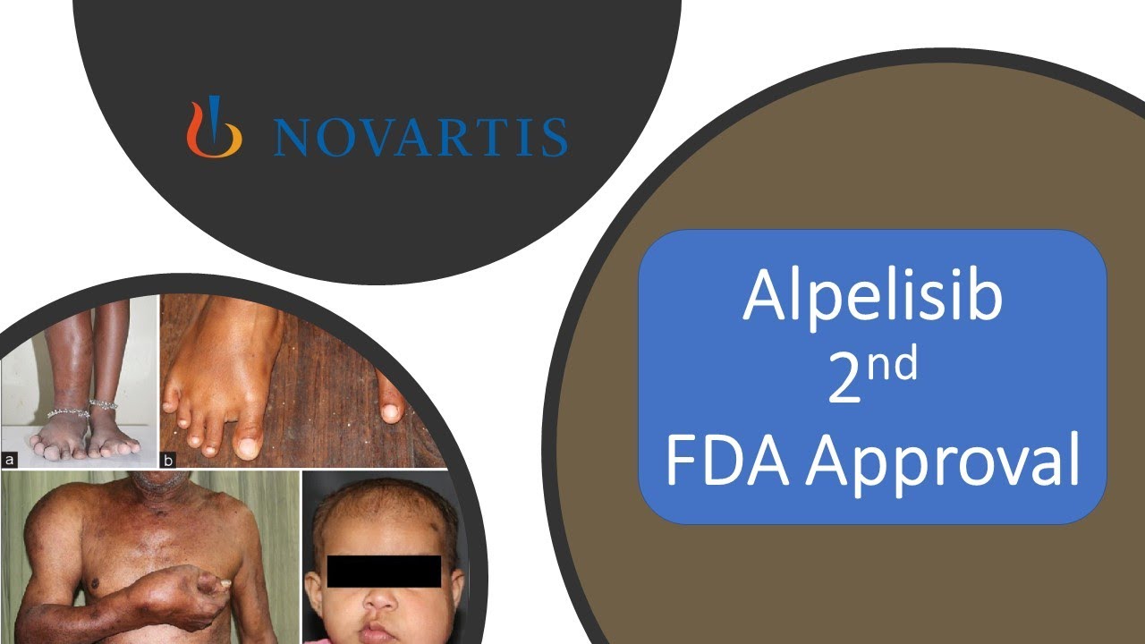 New drug Approval Alpelisib in rare disease PROS , PIK3CA inhibitor,