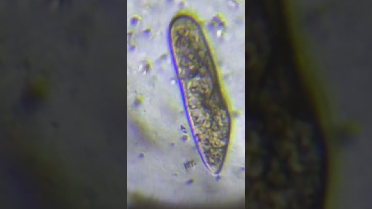 Micro-Traffic Jam! 🚦 The Chaos of Rotifer & Paramecium Buffet 🔬✨#microscopy #tinyworld #paramecium