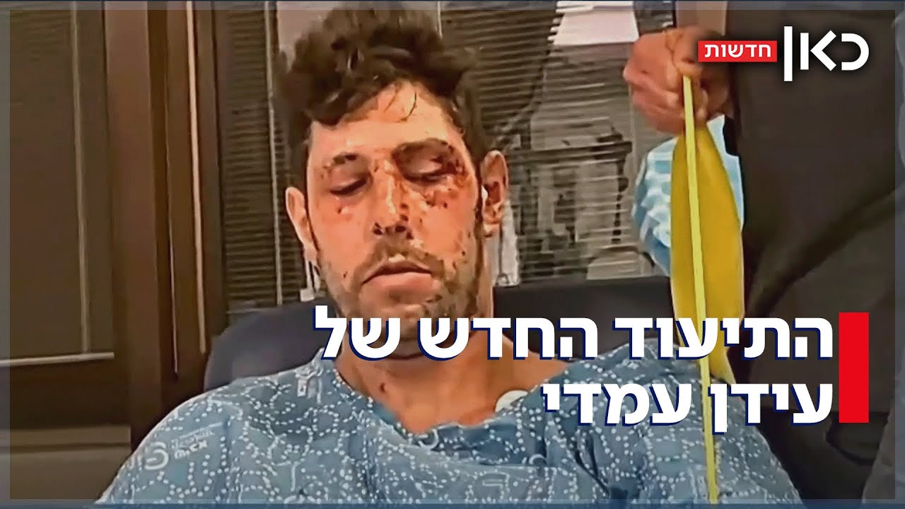 התיעוד החדש ומעורר ההשראה של עידן עמדי - כשנה אחרי שנפצע בעזה