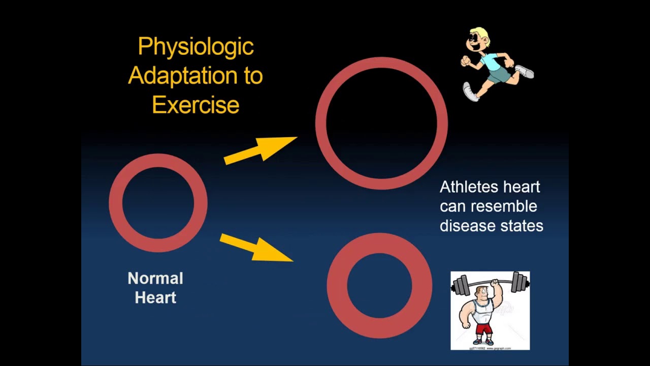 The Emerging Field of Sports Cardiology: Insights & Controversies January 11  2019
