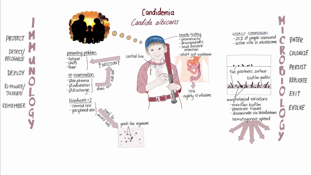 Candidemia Springboard