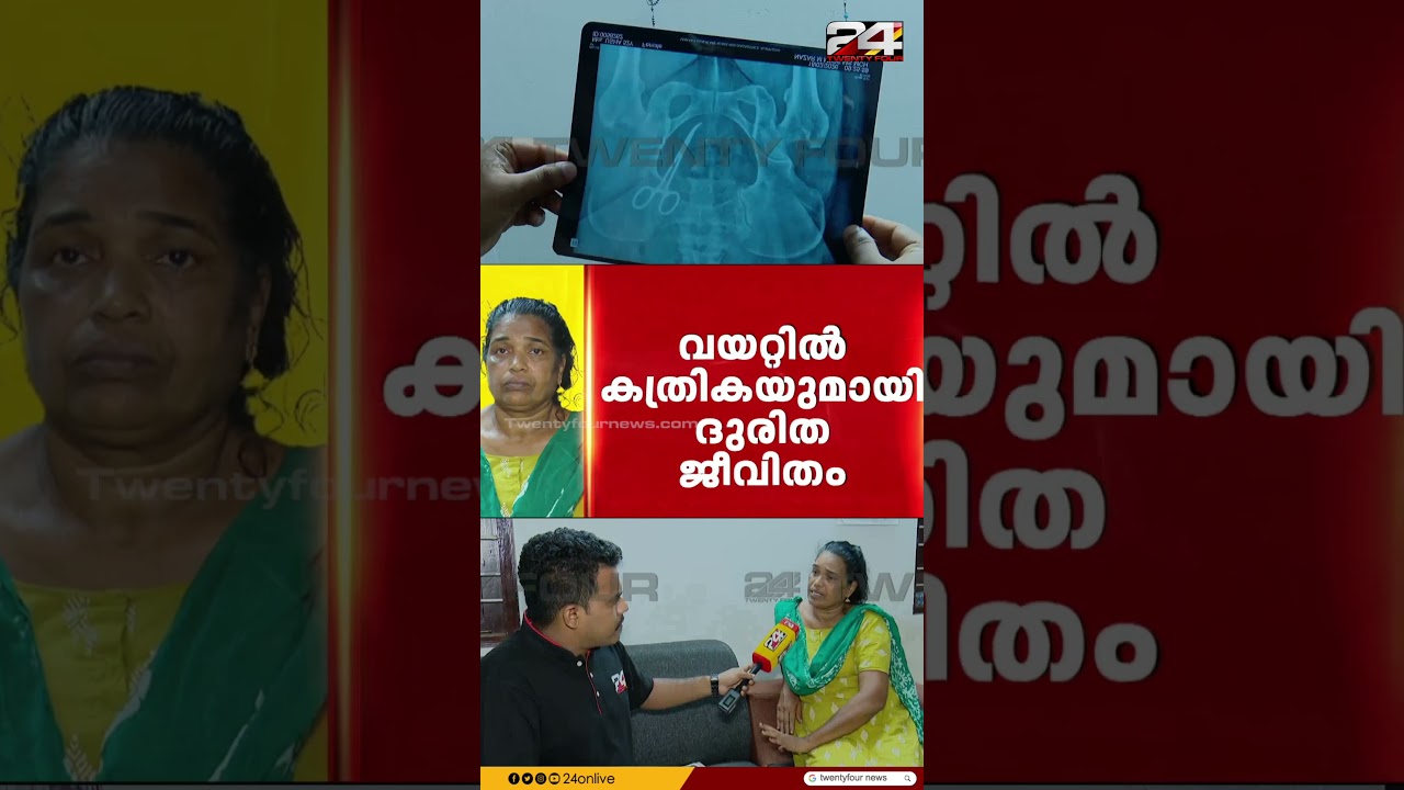 വണ്ടാനം മെഡിക്കൽ കോളജിലെ ശസ്ത്രക്രിയയിൽ അനാസ്ഥ;5 വർഷം വയറ്റിൽ കത്രികയുമായി പുന്നപ്ര സ്വദേശി ഉഷ ജോസഫ്