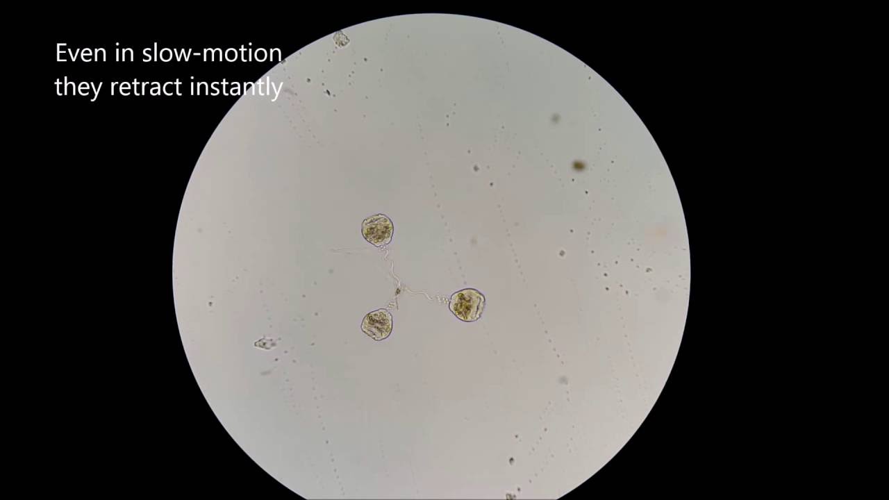 Vorticella, fastest organism on the planet