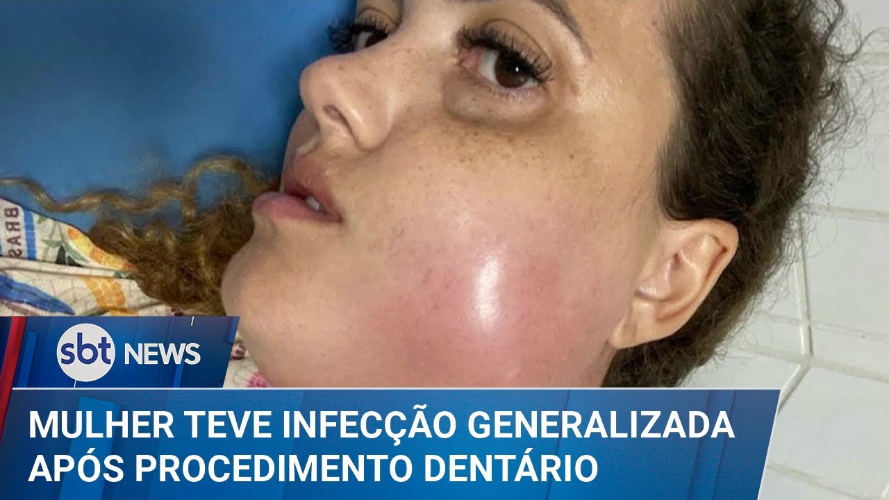Mulher morre de infecção generalizada após procedimento dentário | SBT News (12/03/25)