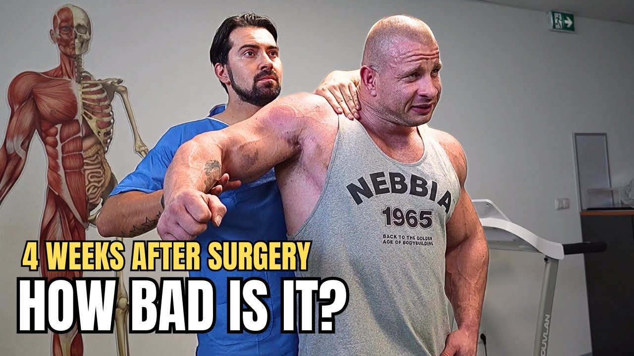 Krizo Road to Recovery - 4 Weeks After Shoulder Surgery