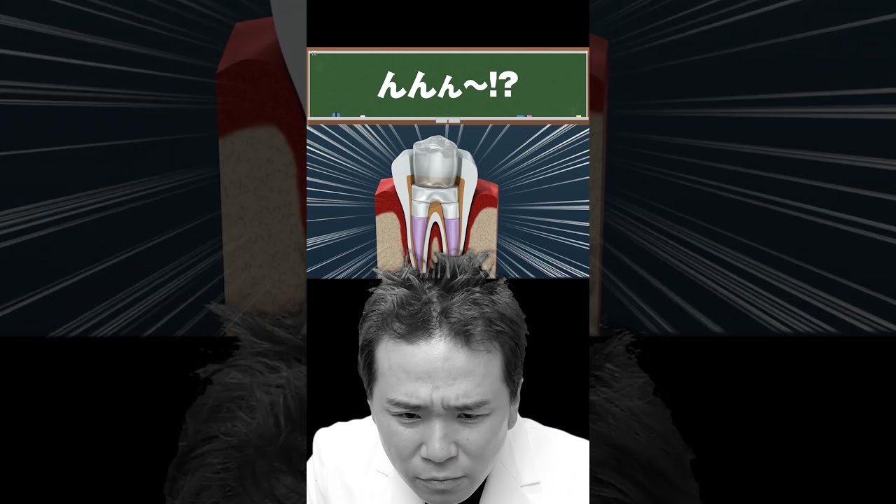 根管治療の動画がツッコミどころ満載だった