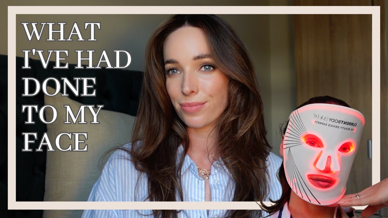 WHAT I'VE HAD DONE TO MY FACE | Botox? Dermal Filler? Lips? | Bridal Beauty Prep Ep2 Ciara O Doherty