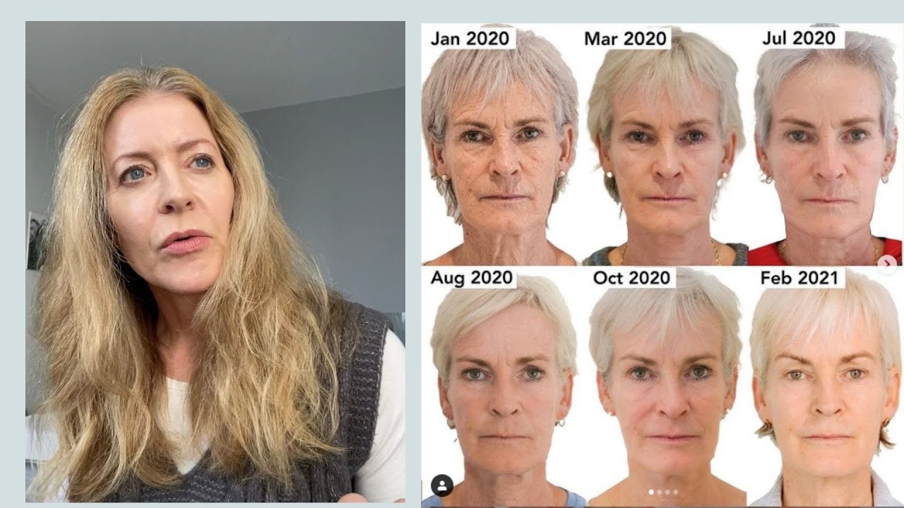 Those Judy Murray before-and-after photos | Alice Hart-Davis