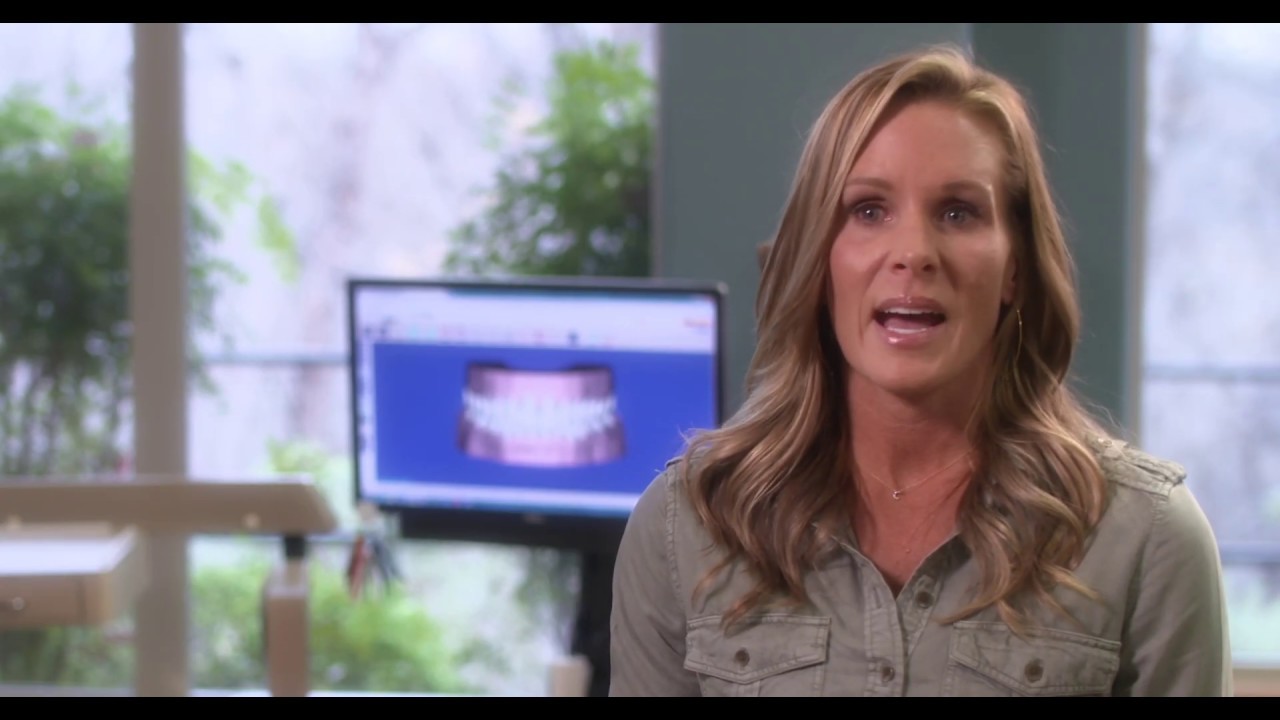 SureSmile® Aligner Patient Testimonial - Christa