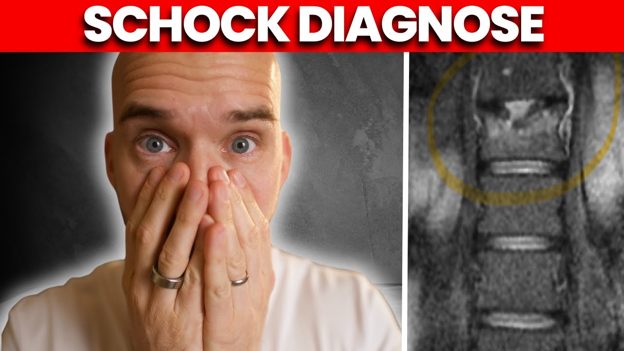 Mein Wirbel ist gebrochen: Wirbels&auml;ule wieder aufbauen in 12 Wochen!