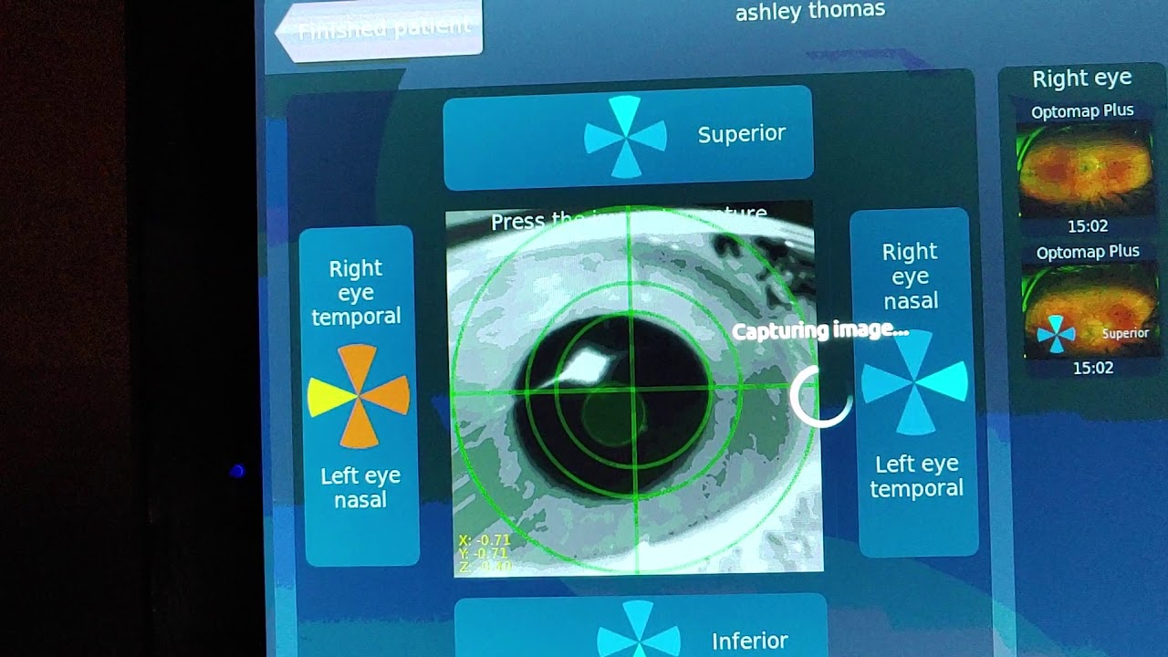 Optomap / Optos steering photos