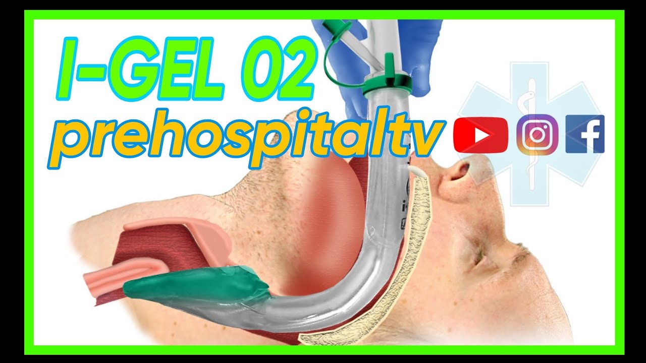 ⭐️💥IGEL 02- VÍA AÉREA💥⭐️