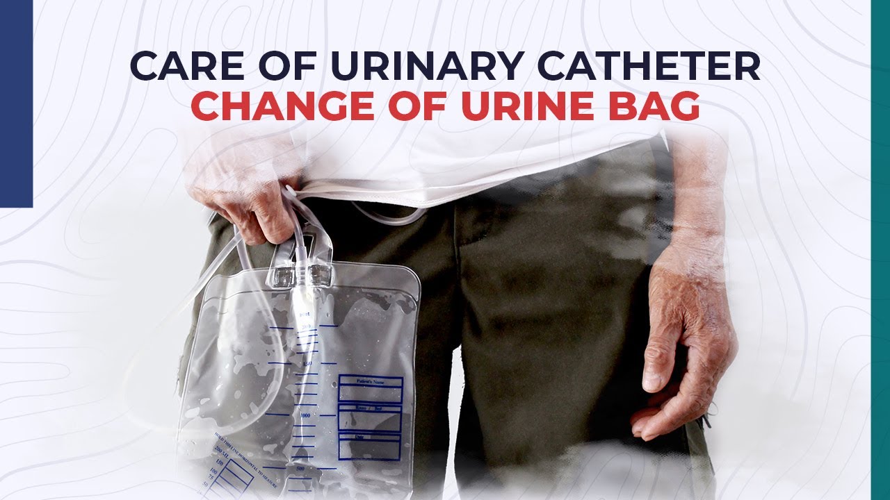 Care of Urinary Catheter - Change of Urine Bag