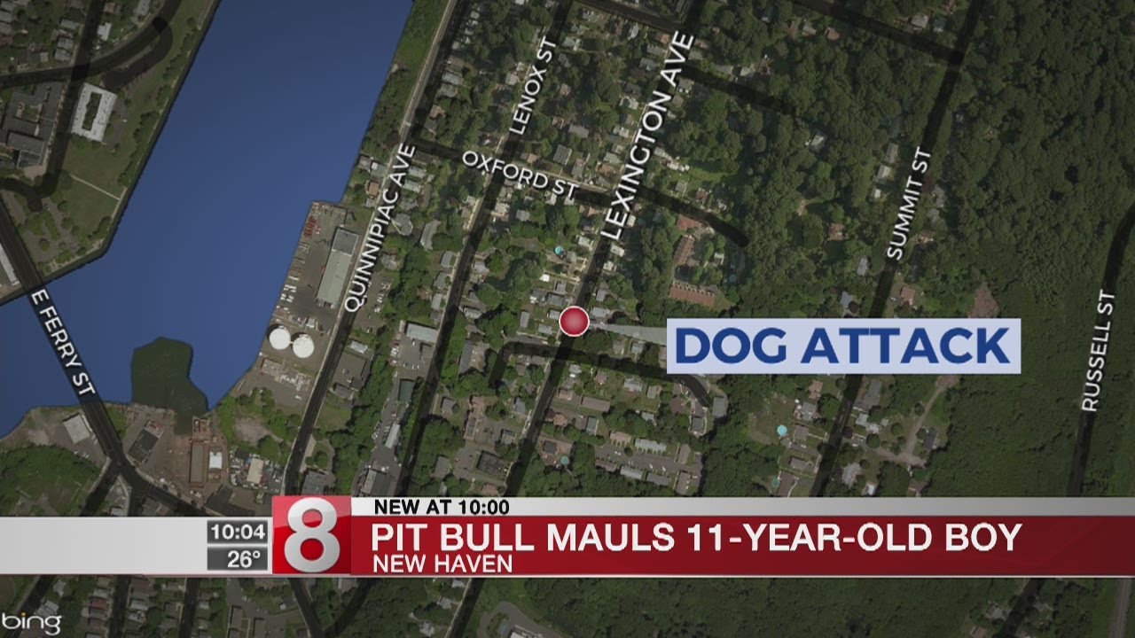 Pit bull mauls 11-year-old boy