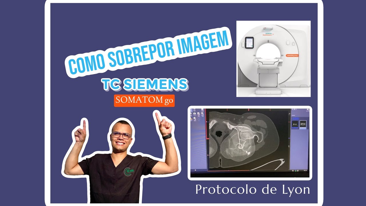 SOBREPOR IMAGEM NO TOMÓGRAFO SIEMENS SOMATOM GO