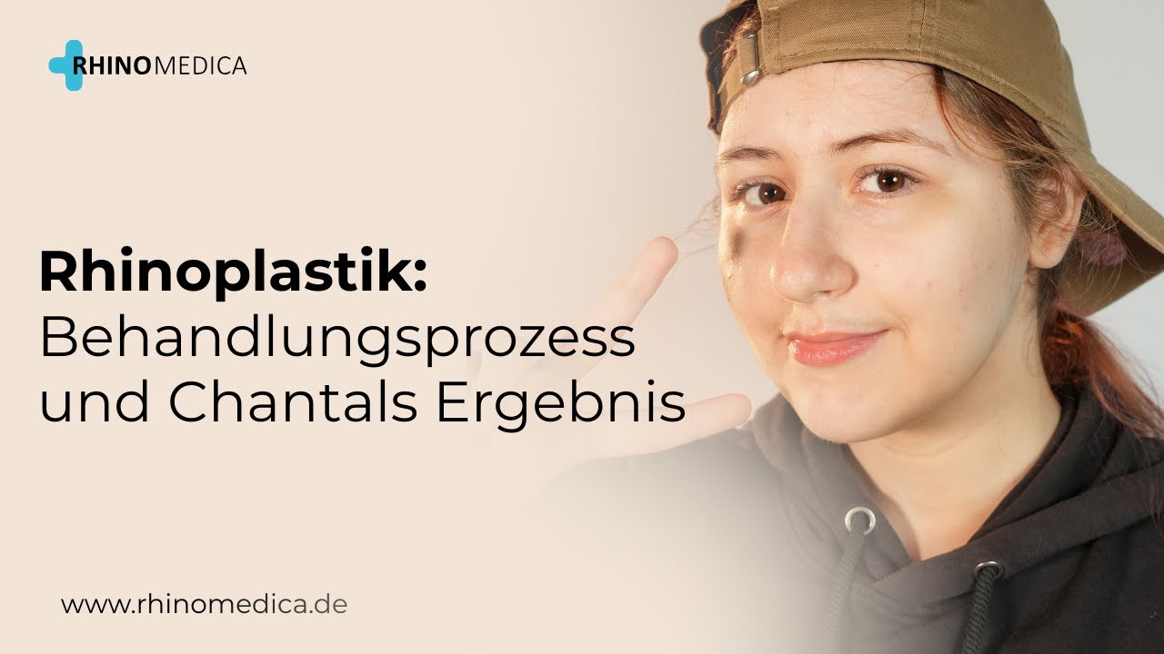Rhinoplastik: Behandlungsprozess und Chantals Ergebnis