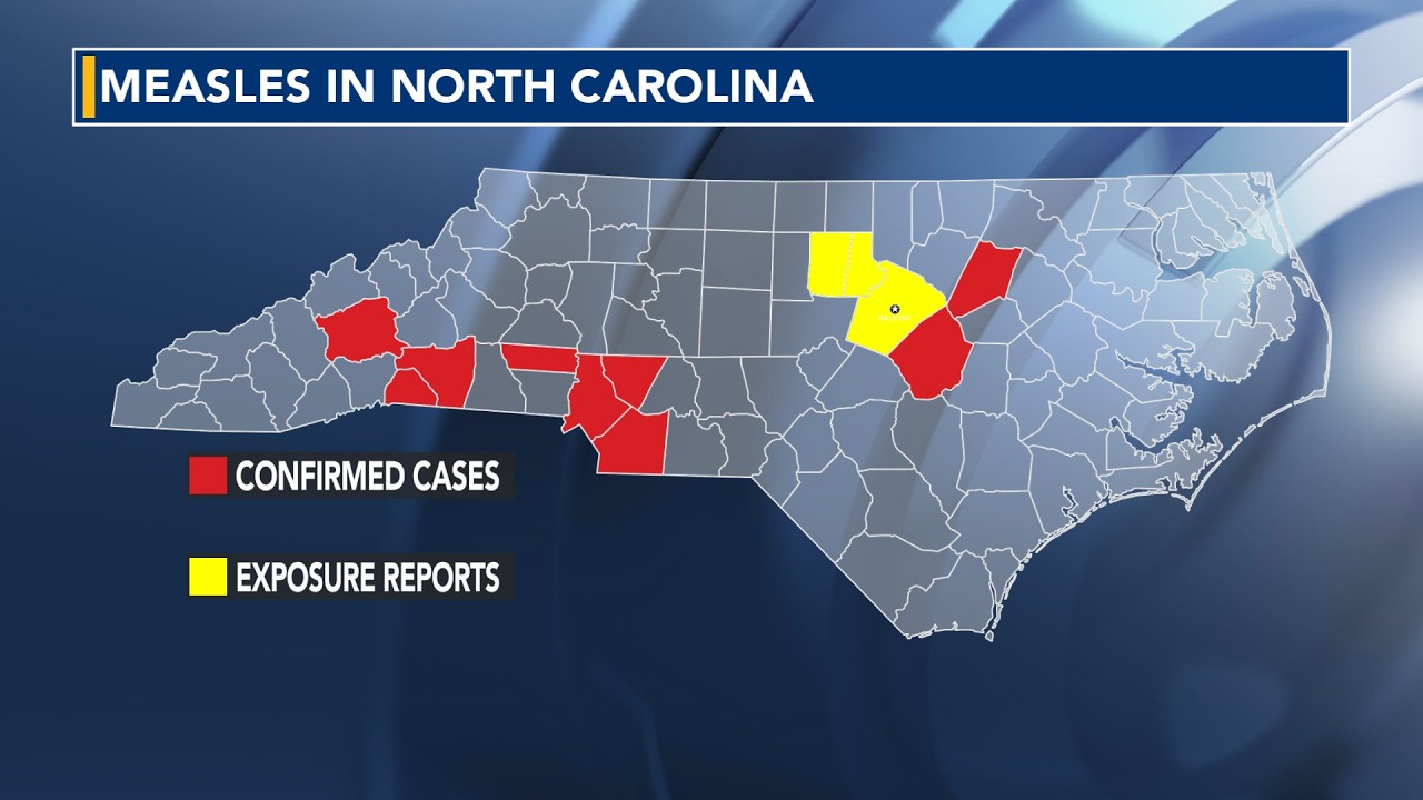 Measles in central NC: Live Q&A on how to stay safe
