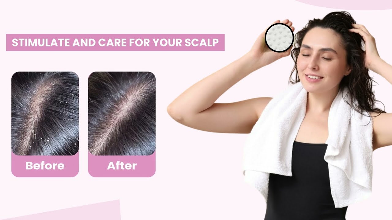 Mildcares Hair Scalp #Massager: The Ultimate Tool for Healthier Hair & Relaxation!