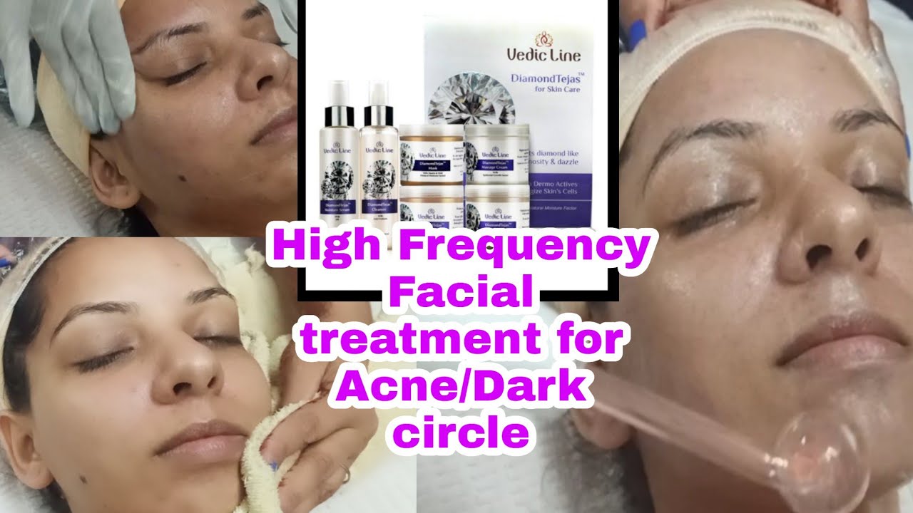 High Frequency Ozone Facial for Pimple and Dark Circle Treatment|| Vedicline Diamond Tejas facial
