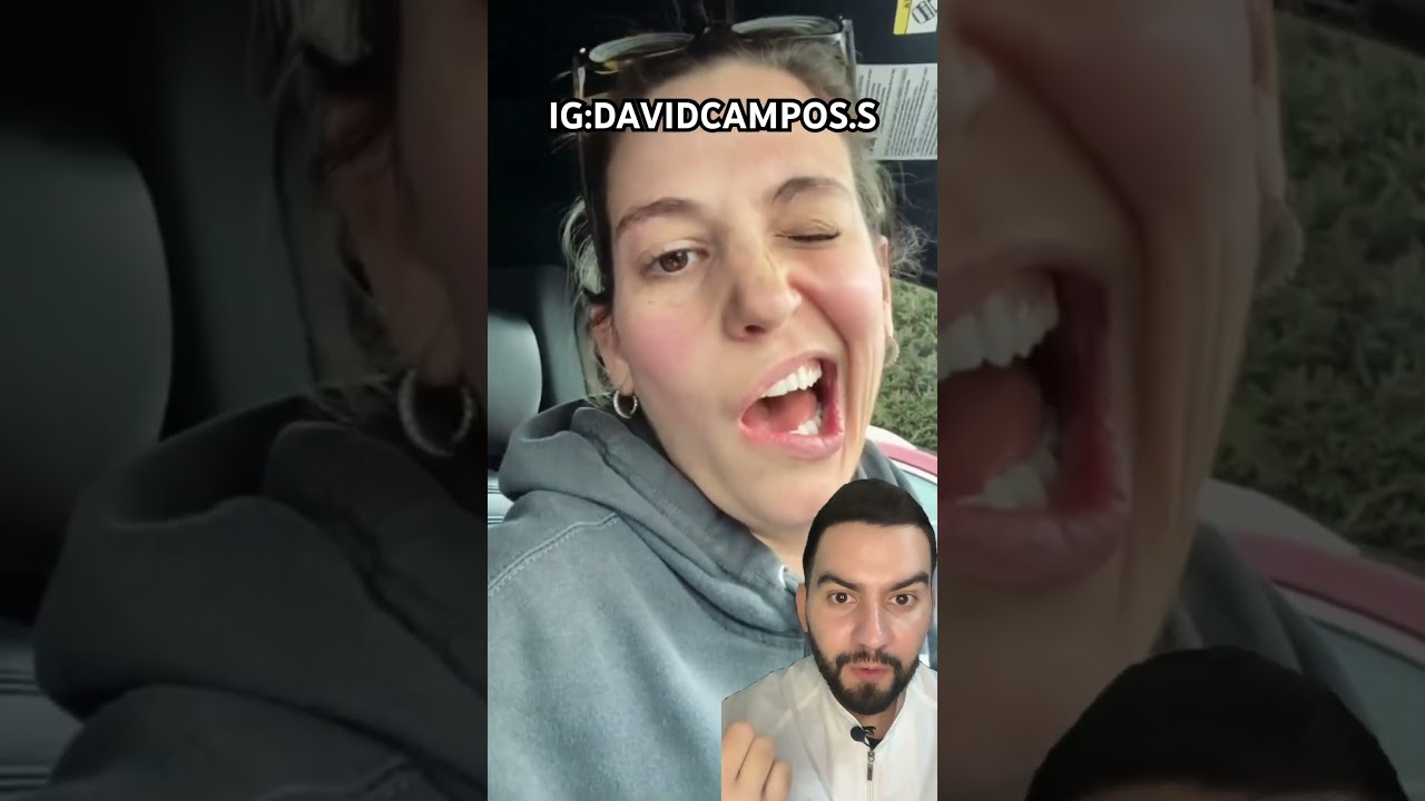 PAR&Aacute;LISIS FACIAL