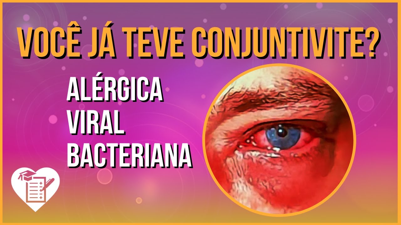CONJUNTIVITE: Tipos, Sintomas e Tratamento