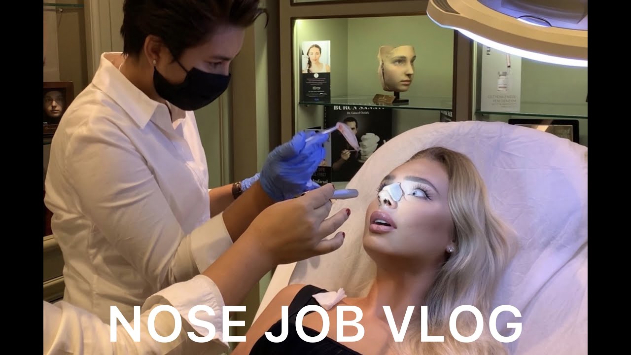IS MY NOSE BOTCHED? RHINOPLASTY  IN TURKEY. DR GUNCEL OZTURK. WHOLE TRUTH. PART 1.