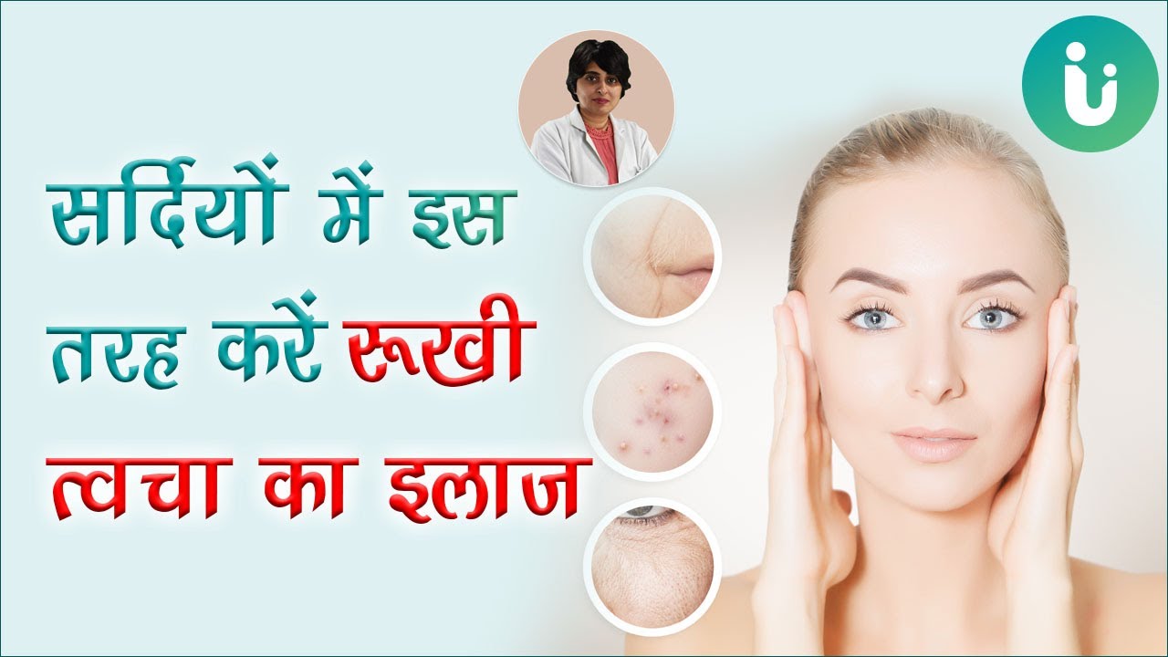 रूखी त्वचा, ड्राई स्किन का इलाज - Dry skin treatment in winter in hindi by Dr. Nirupama Parwanda