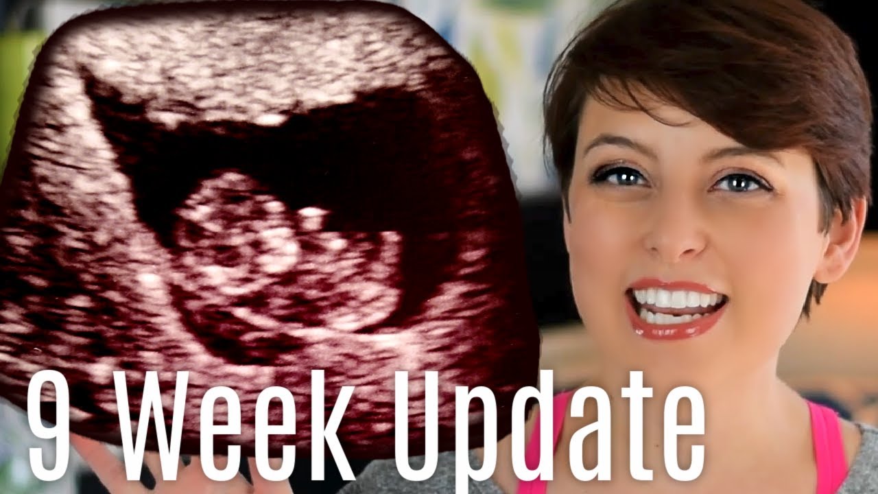 Ultrasound Results After Bleed At 7 Weeks | 8-9 Week Pregnancy Update | JAKS Journey [CC]
