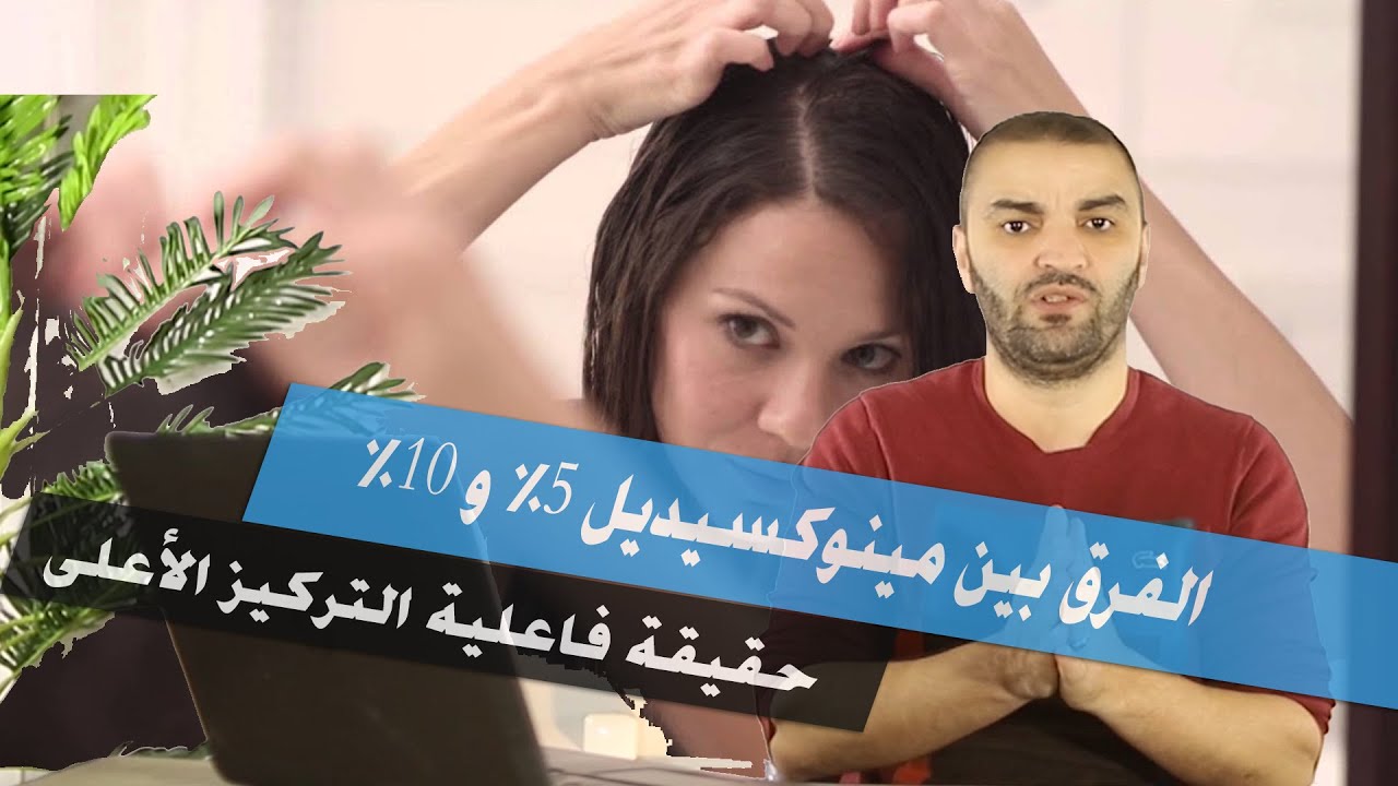 الفرق بين تركيزات المينوكسيديل المختلفة مينوكسيديل 5% و10% وتركيز 15%