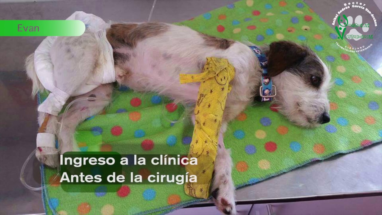 Fractura del Húmero Distal   Caso Evan