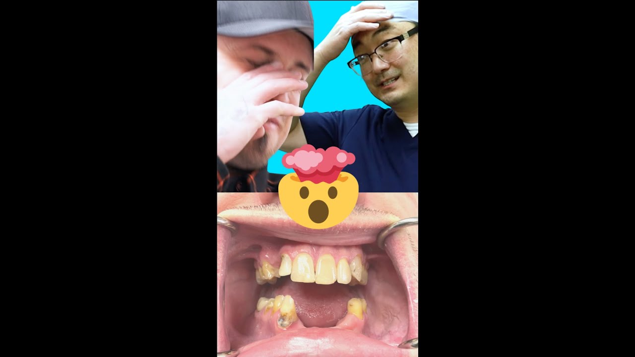 Dental Implants DONE in 24 Hours!?
