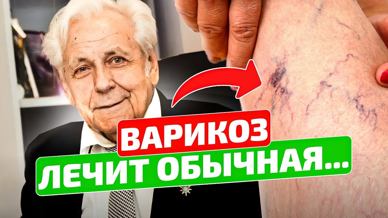 Неумывакин: Сколько раз я писал, что от варикоза помогает обычная... Лучшие рецепты!