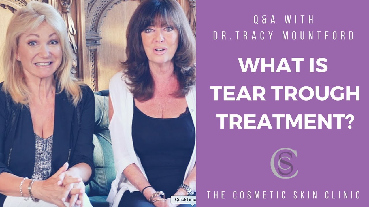 What Is Tear Trough Filler Treatment ft. Debbie Arnold & Vicki Michelle | The Cosmetic Skin Clinic