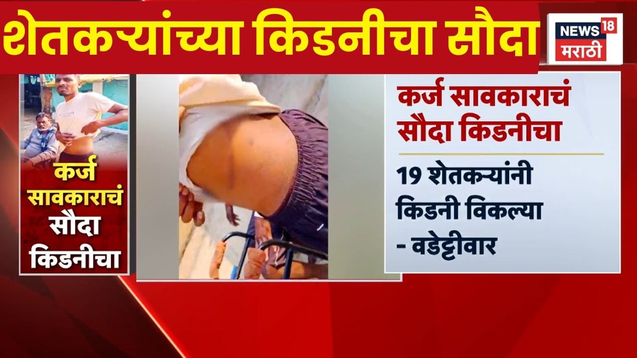 Kidney Selling News | सावकारांच्या जाचाला कंटाळून १९ शेतकऱ्यांनी किडनी विकल्याचा वडेट्टीवारांचा दावा