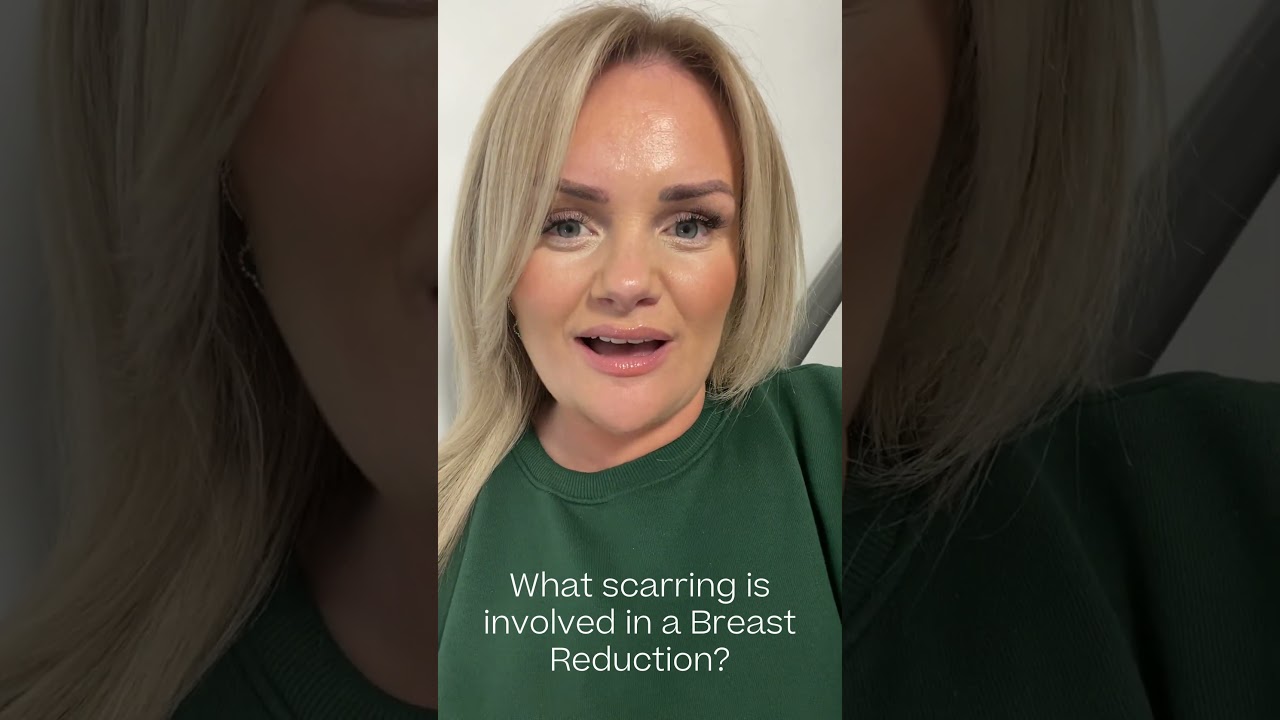 Scarring you can expect following Breast Reduction surgery...