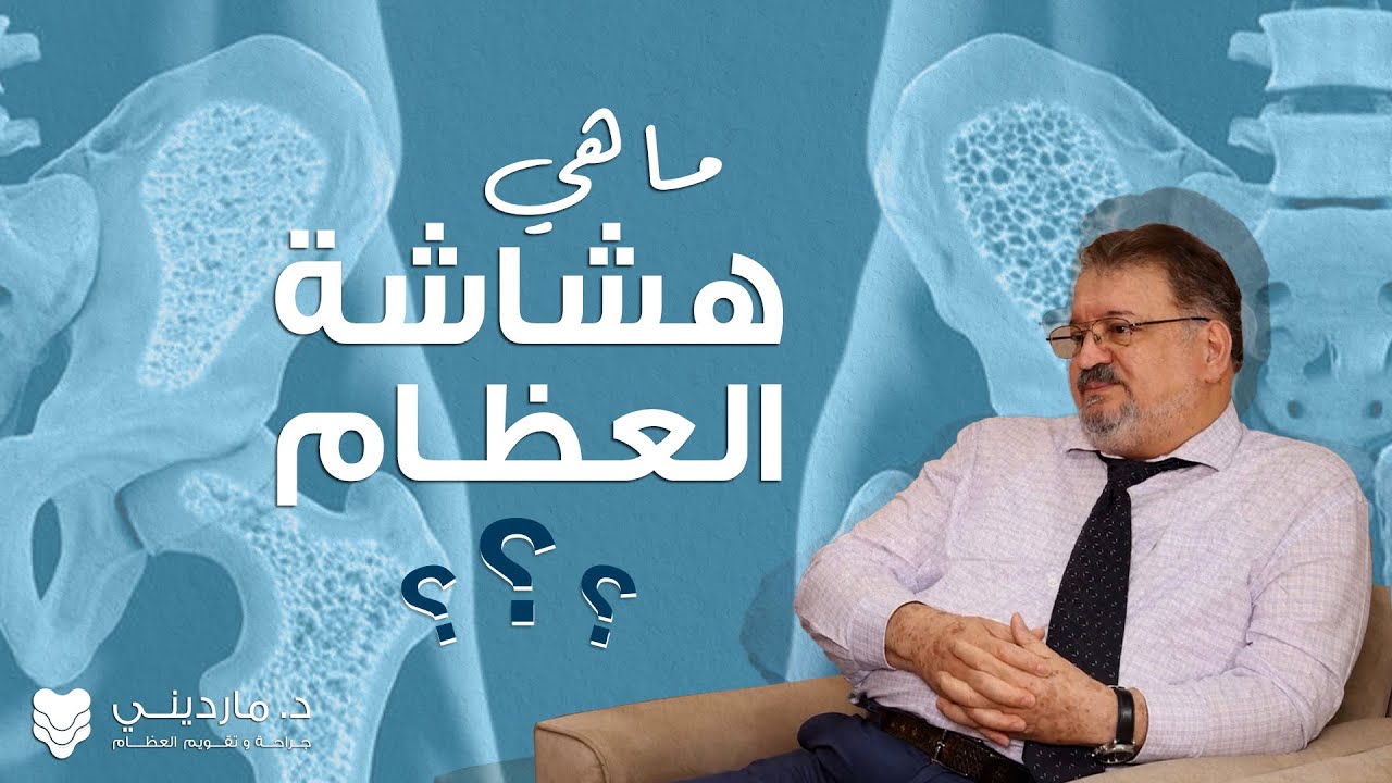 ماهي هشاشة العظام - دكتور عصام مارديني Dr. Issam Mardini