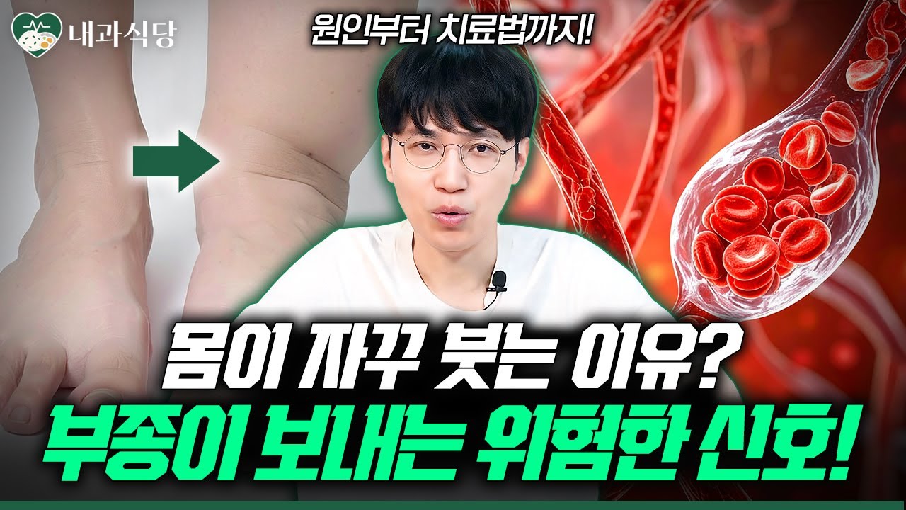몸이 붓는 이유, 위험 신호부터 생활습관까지 한눈에!