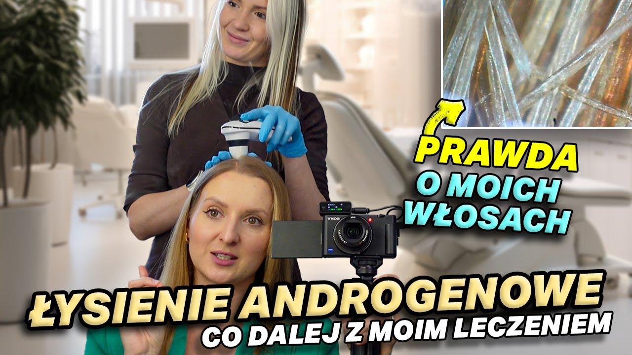 ŁYSIENIE ANDROGENOWE - WIZYTA U TRYCHOLOGA + HAUL Z WYPRZEDAŻY MOHITO 