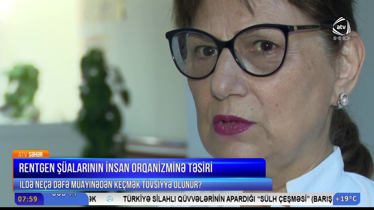 Rentgen şüalarının insan orqanizminə təsiri (ATV Səhər)