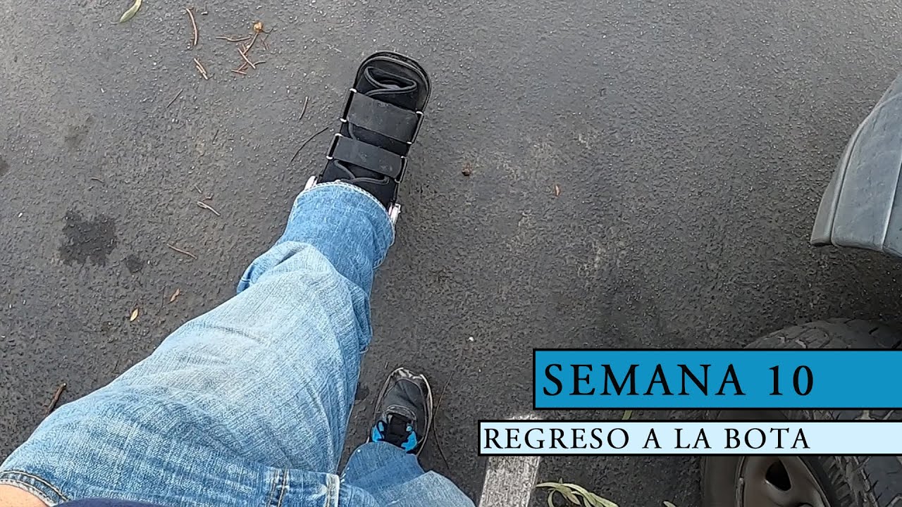 Semana 10: Recuperacion rotura del tendón de Aquiles no cirugia no doctor