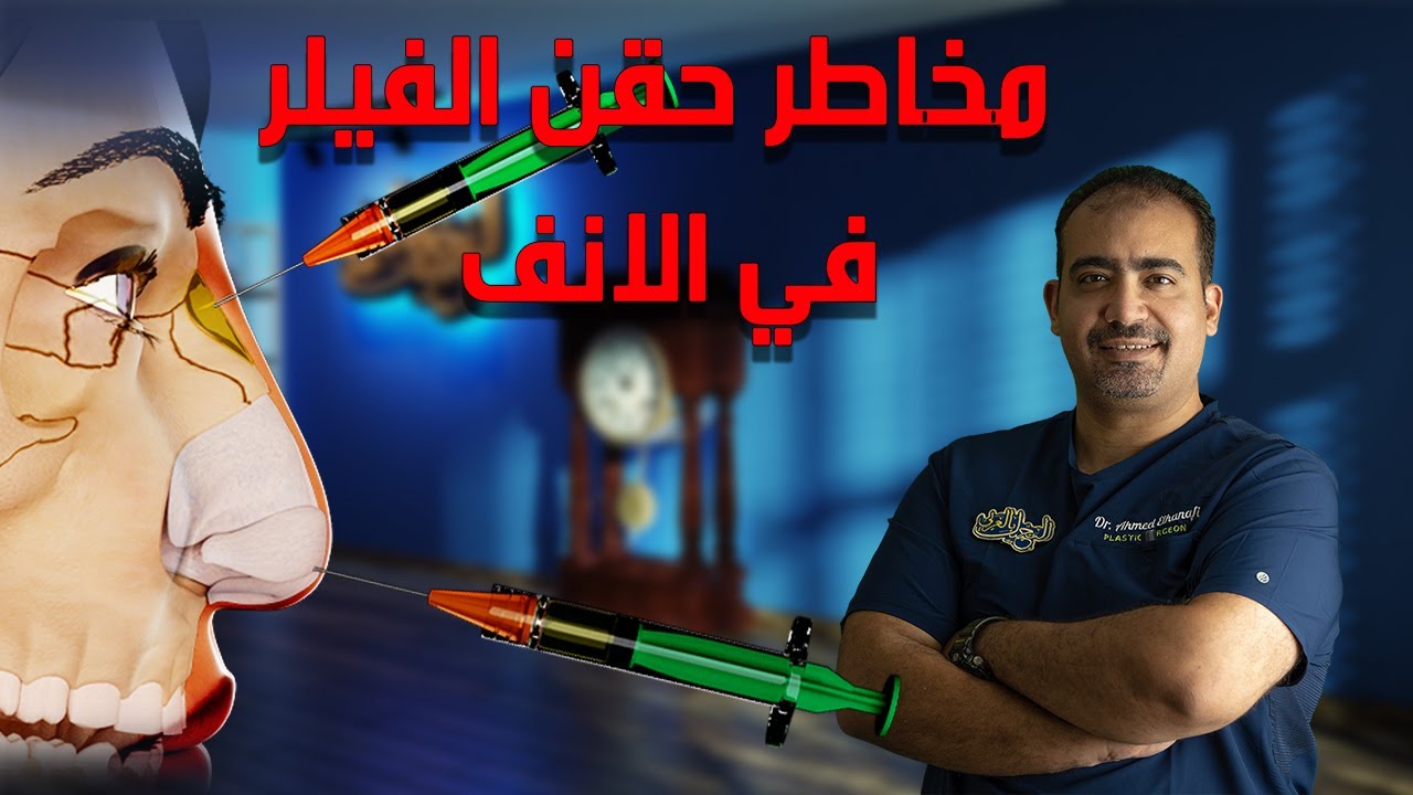 تجميل الانف بدون جراحة : مخاطر حقن الفيلر بالانف
