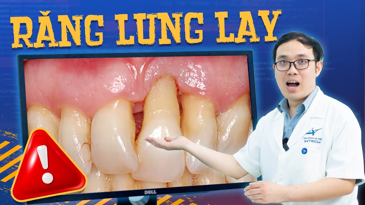Răng Lung Lay Làm Sao Cho Chắc Lại? 2 Cách Chữa Hiệu Quả Mà Không Cần Nhổ - Xem Ngay!