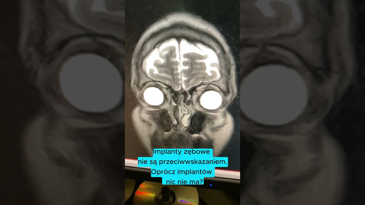 rezonans magnetyczny głowy